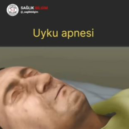 Oral Sleep Provider | Uyku Apnesi Tedavisi